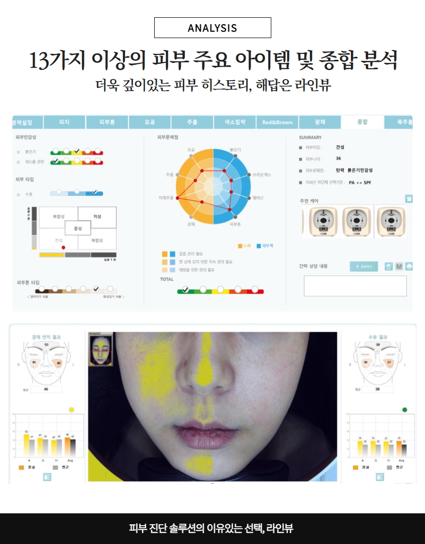루시아 피부관리 이미지
