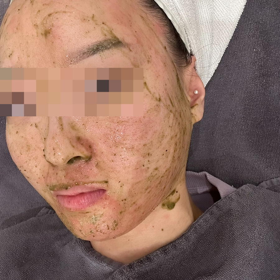 그린필스킨케어 이미지