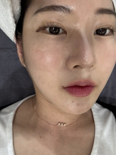 그린필스킨케어 이미지