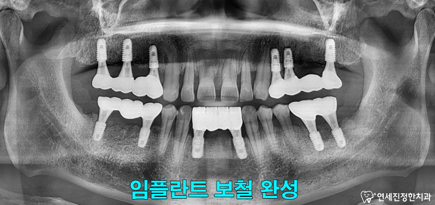 연세진정한치과 이미지