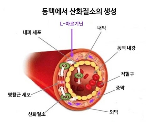 산화 이미지