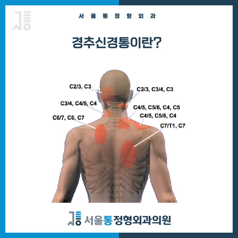 서울통정형외과의원 이미지