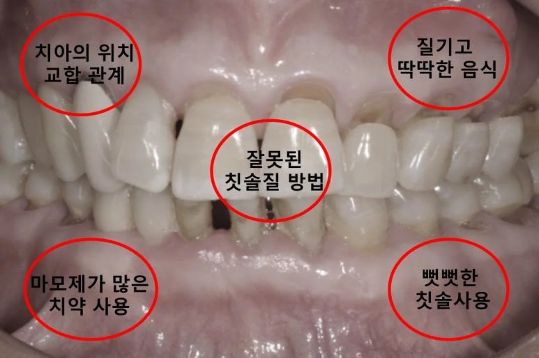 서울닥터윤치과 이미지