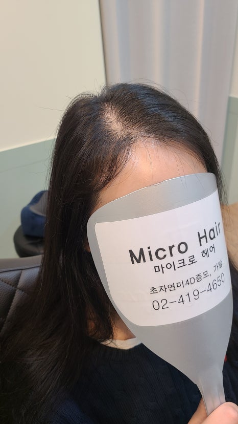 마이크로헤어증모 이미지