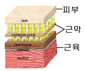 바이칼휘트니스 이미지