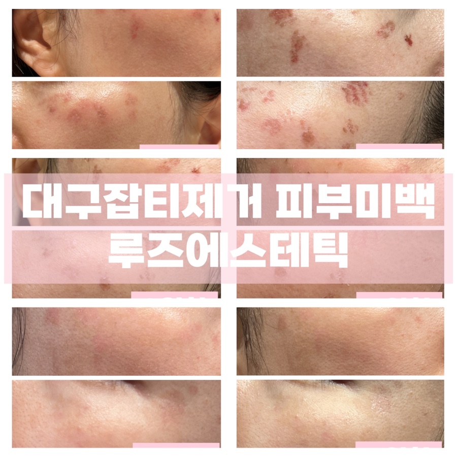 루즈에스테틱 이미지