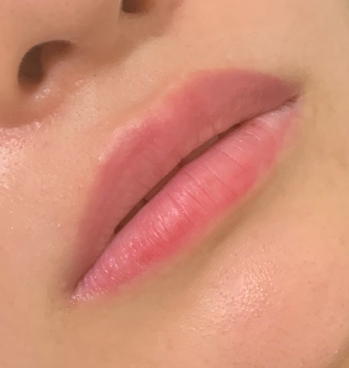 인레브 이미지