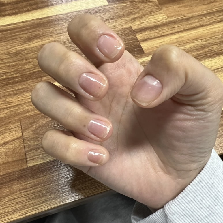 요기 서네일 이미지