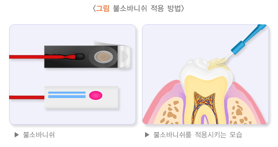 서울닥터윤치과 이미지