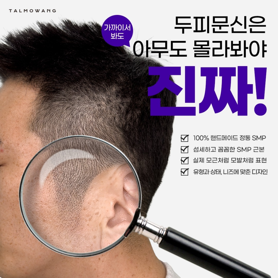 탈모왕수원 이미지