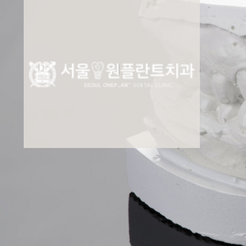 서울원플란트치과의원 이미지