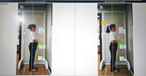 바른체형 작은얼굴 이미지