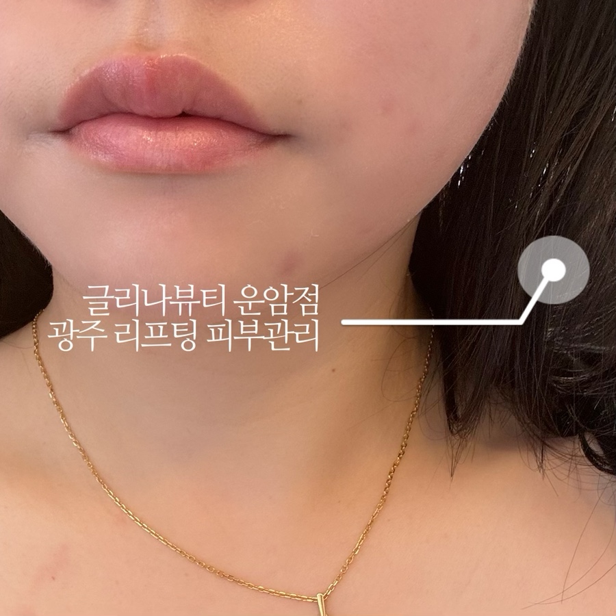 글리나뷰티 이미지