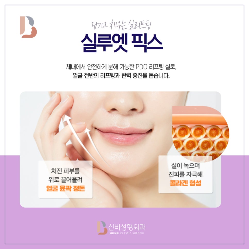 신비성형외과 이미지