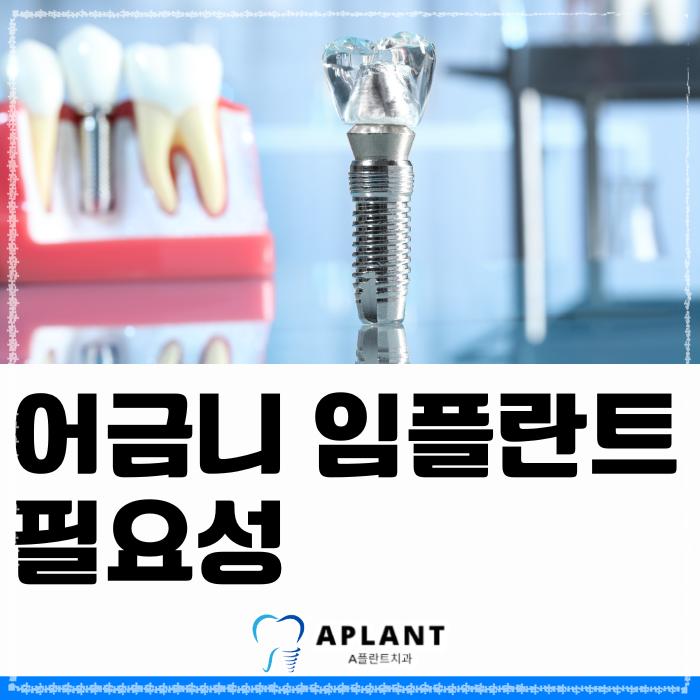 에이플란트치과의원 이미지