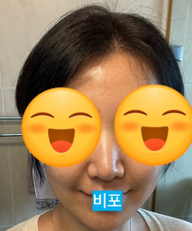 일소바이오 이미지