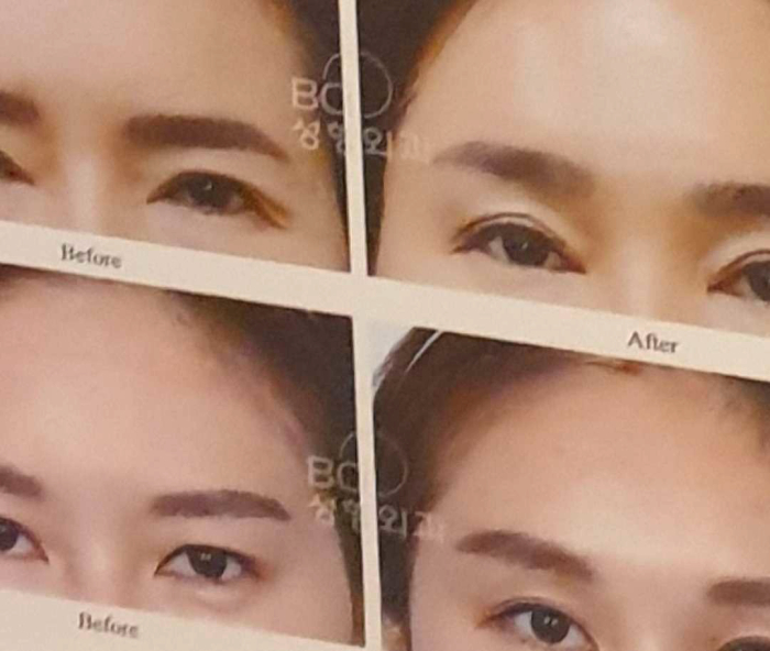 비씨아이 이미지