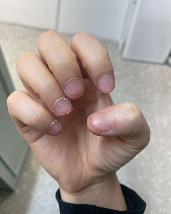 하이영 네일 이미지