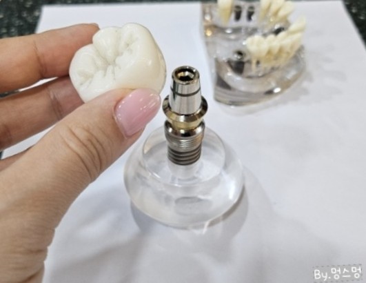 로뎀치과 이미지