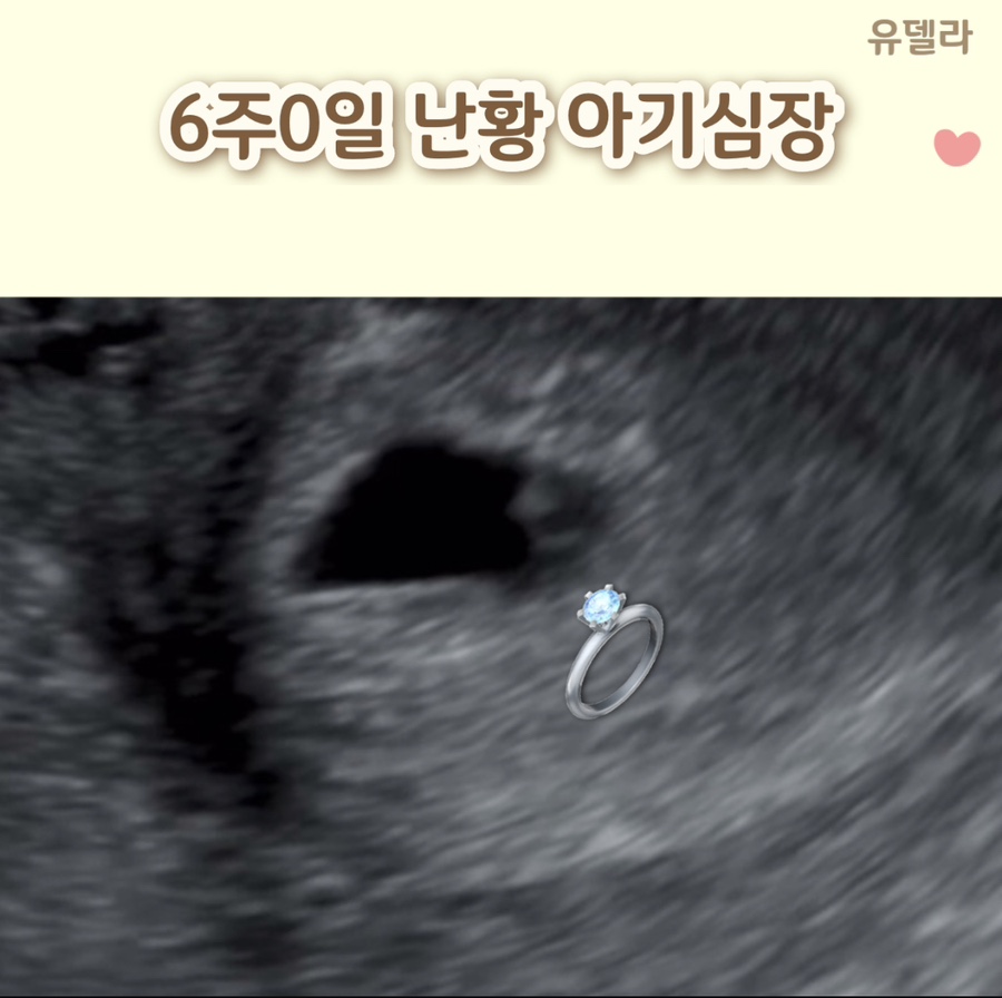 유델라 이미지