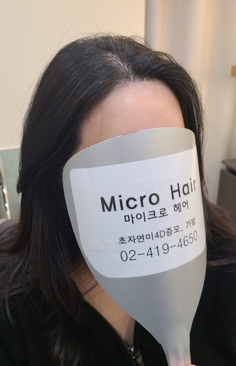 마이크로헤어증모 이미지