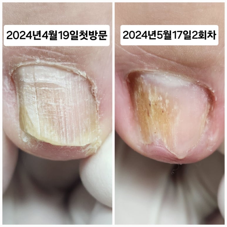 케이큐어 이미지