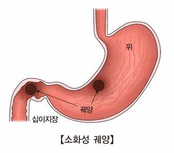 모든O.A 이미지