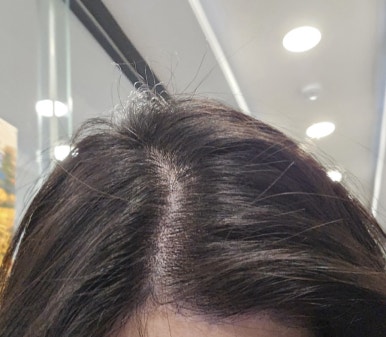 체인지헤어라인 이미지
