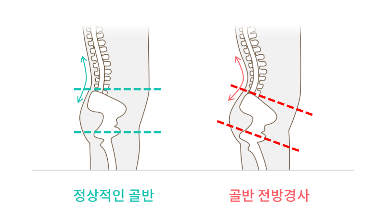 핏온짐 이미지