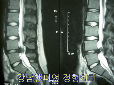 강남챔피언정형외과의원 이미지
