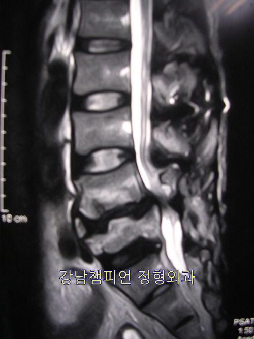강남챔피언정형외과의원 이미지