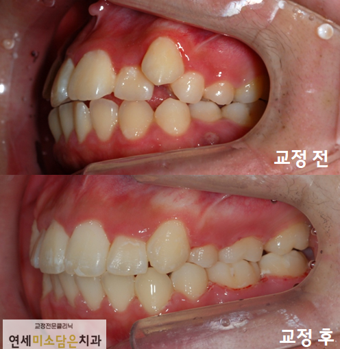 연세미소담은치과 이미지