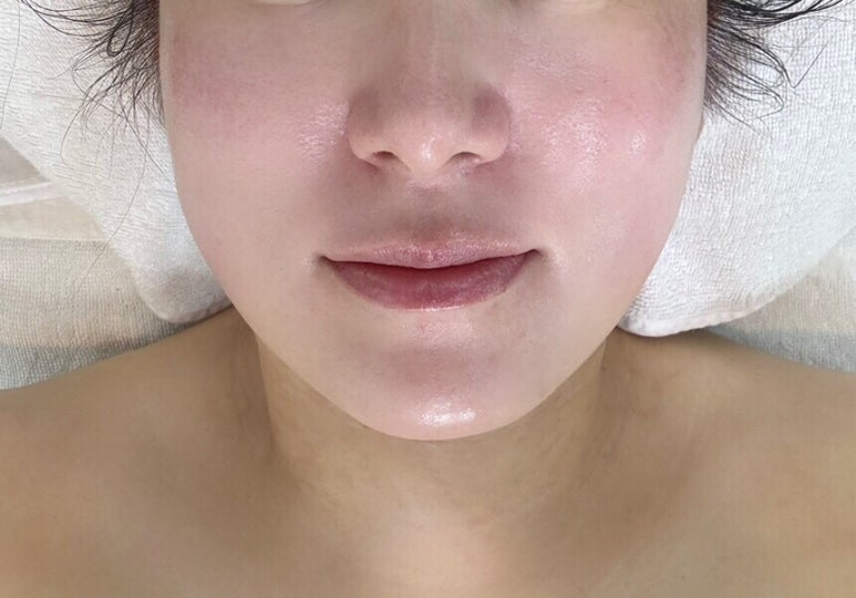 브이라인샵 이미지