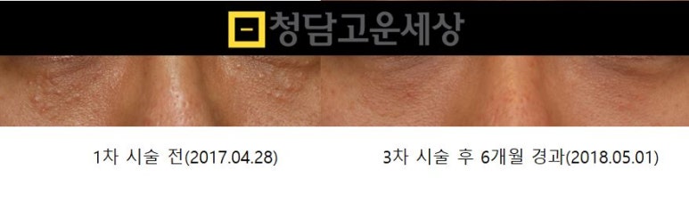 아주고운피부과 이미지