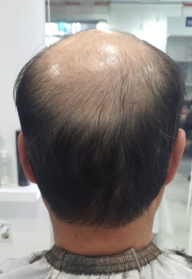 화성미용실김호증모가발 이미지