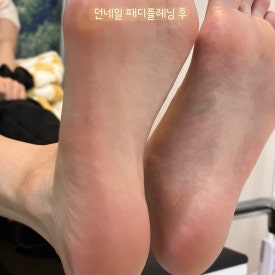 던네일 이미지