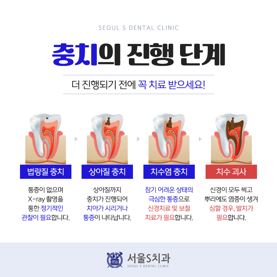 서울뿌리깊은치과의원 이미지