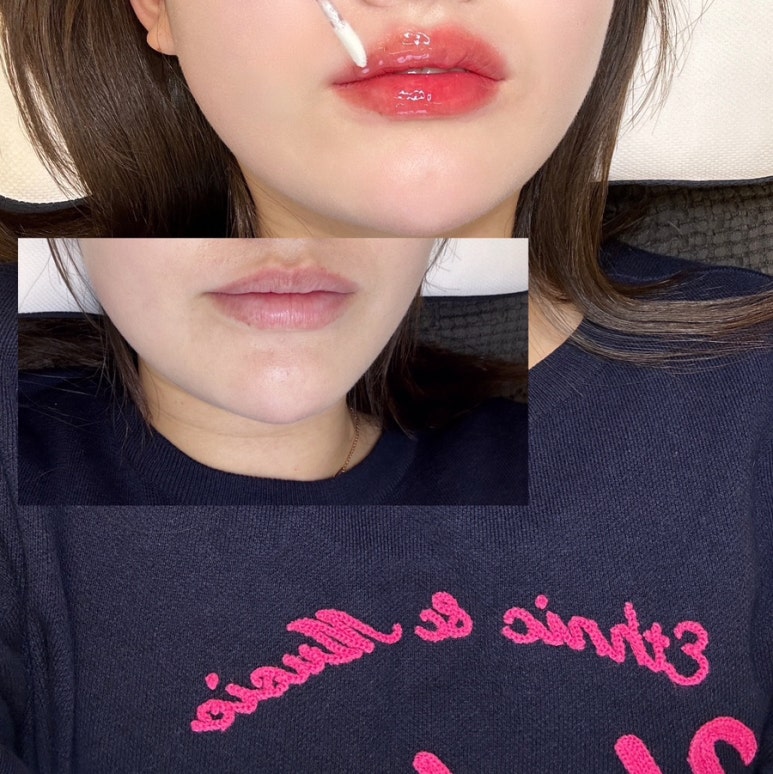 루미아스칼프 이미지
