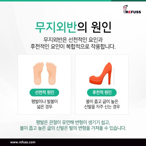 레푸스 이미지
