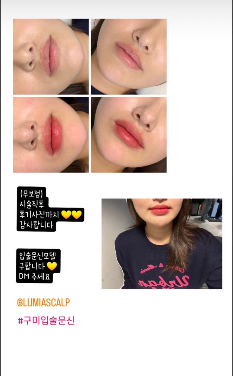 루미아스칼프 이미지