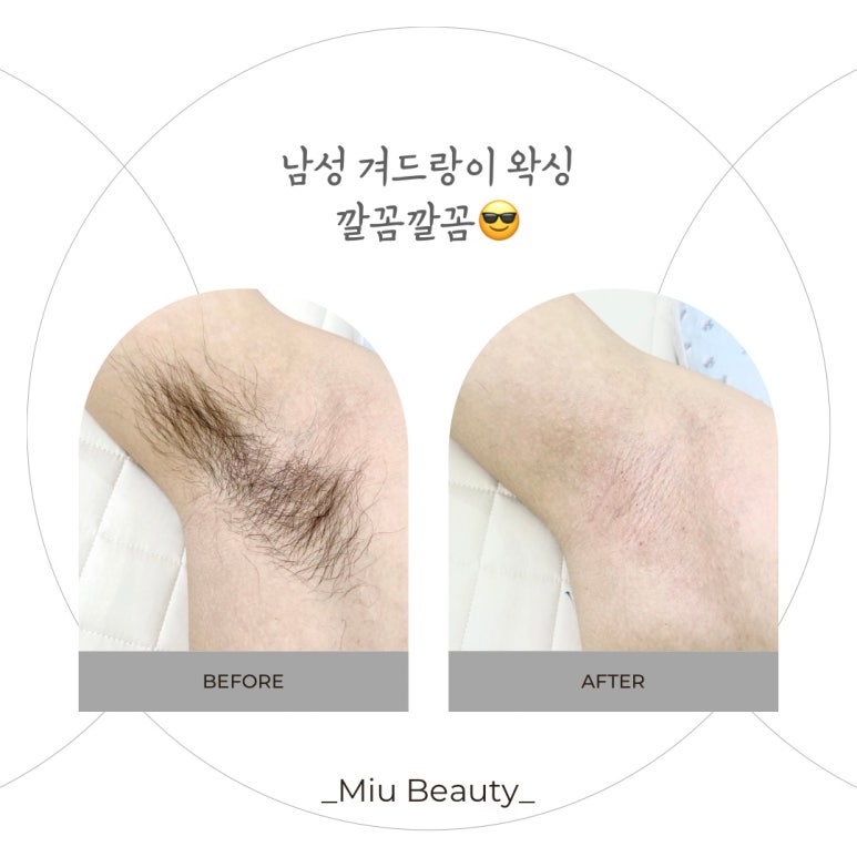 미우뷰티 이미지