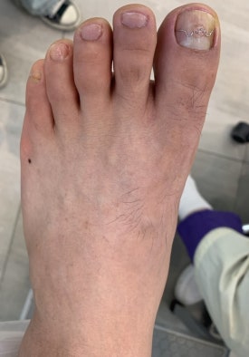 이천문제성발전문#라파엘 이미지