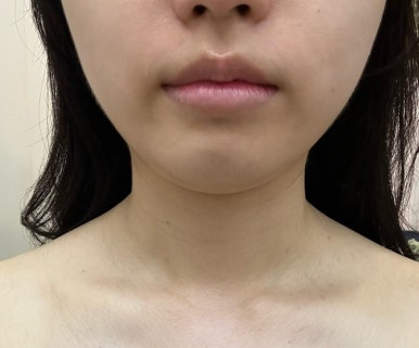 가꾸미에스테틱 이미지