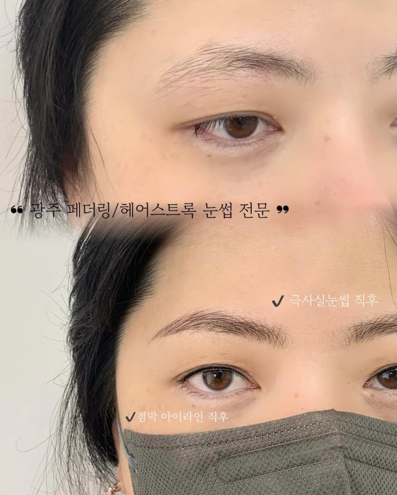 다움스킨 이미지