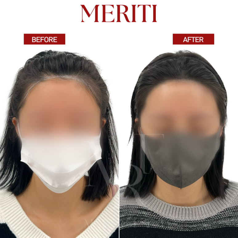 라인컨설팅 이미지