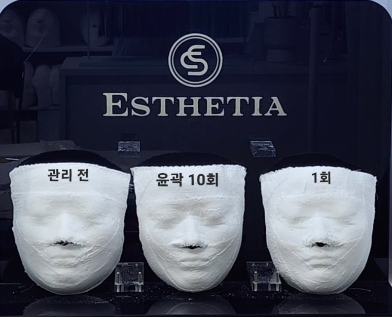 에스테티아세종소담 이미지