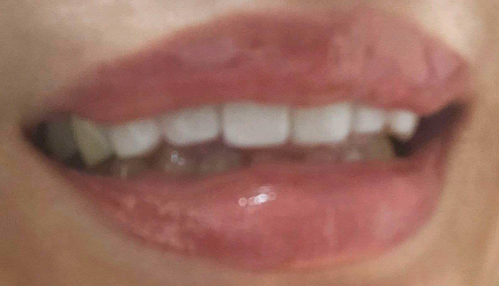 루체치과의원 이미지