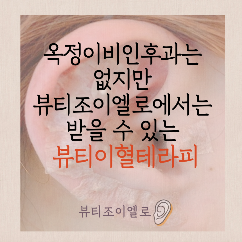 조이엘로 뷰티 이미지