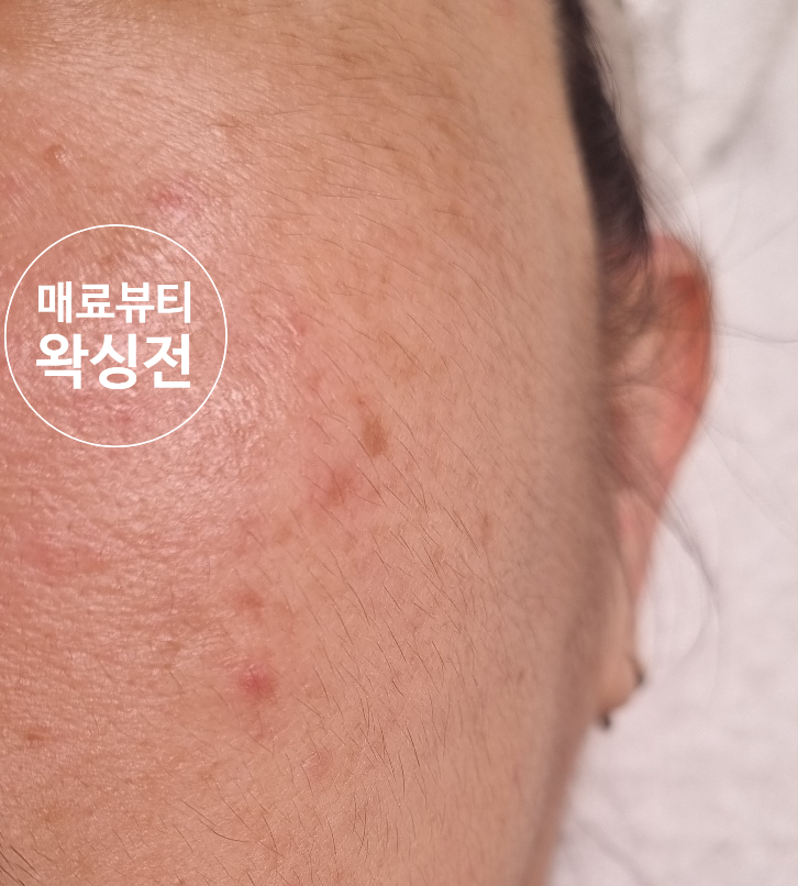 진해왁싱매료뷰티 이미지