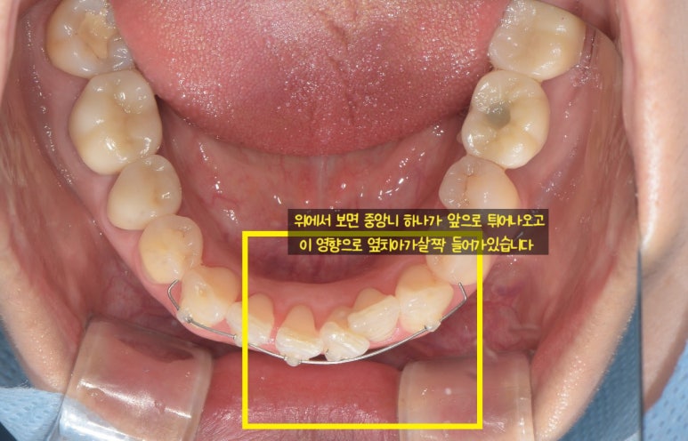 서울닥터윤치과 이미지